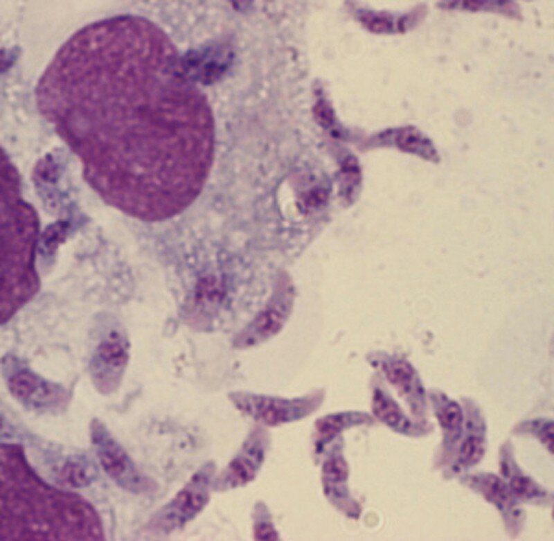 Le médicament contre les helminthes et les parasites pour la personne la prophylaxie